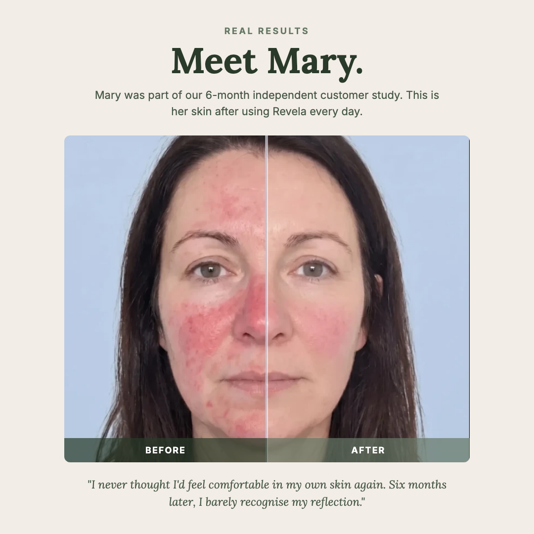 Before and after - Meet Mary - 6 month independent customer study results