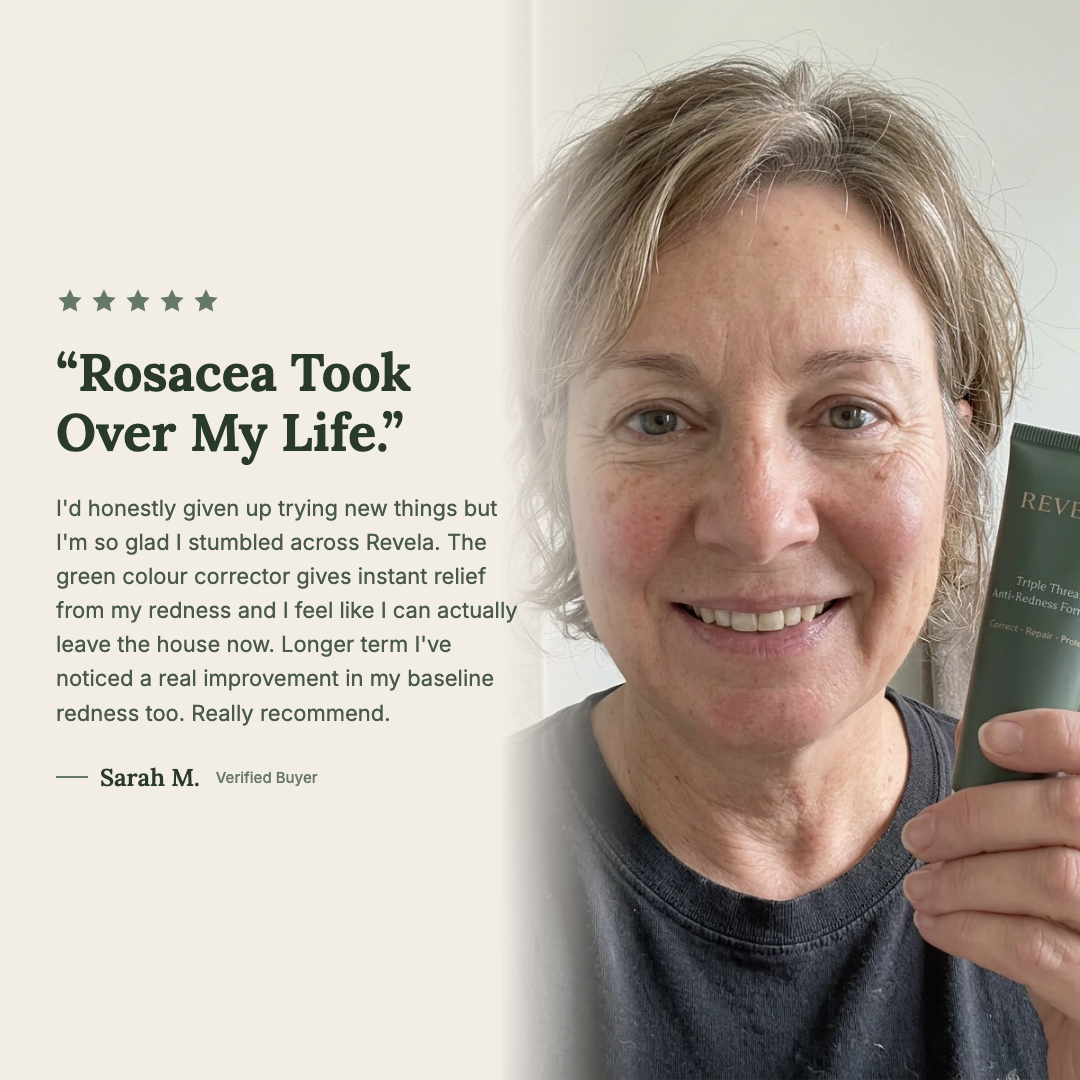 Customer review - Sarah M. - Rosacea Took Over My Life