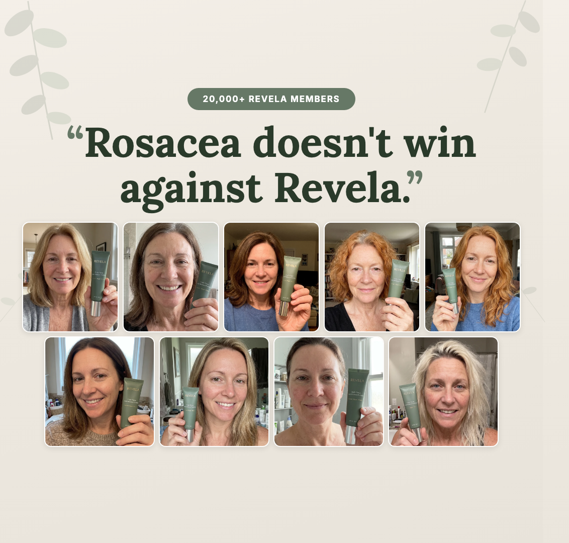 Rosacea doesn't win against Revela - 20,000+ Revela Members
